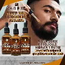 F25 RS Minoxidil Promos 5.webp