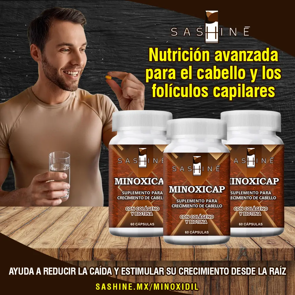 F25 RS Minoxidil 01 Minoxicap.webp